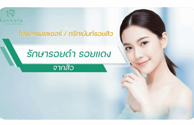 รักษา รอยดำ รอยแดง