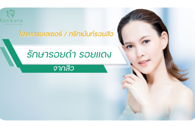 รักษารอยดำ รอยแดง