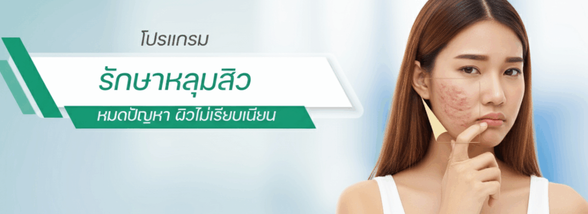 หลุมสิว rolling scar