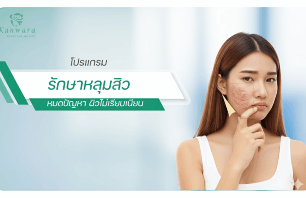 หลุมสิว rolling scar