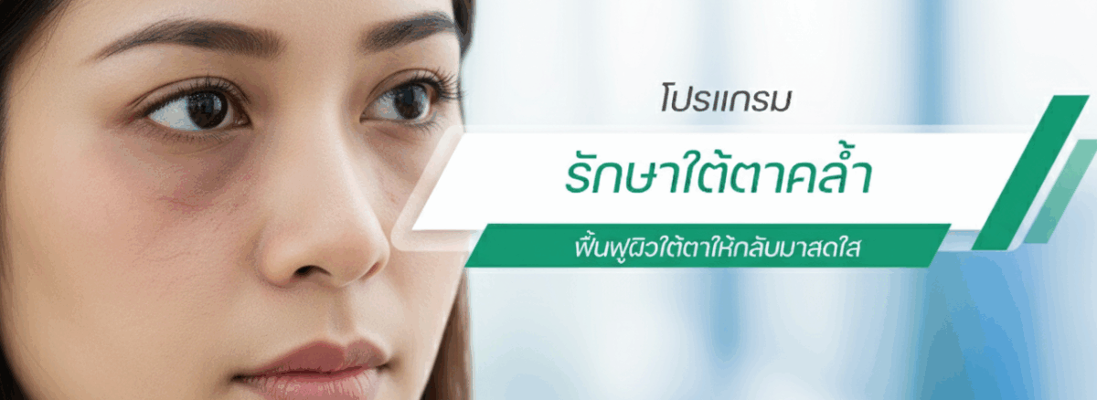 เส้นเลือดใต้ตาคล้ำ