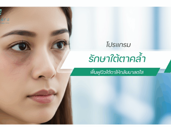 เส้นเลือดใต้ตาคล้ำ