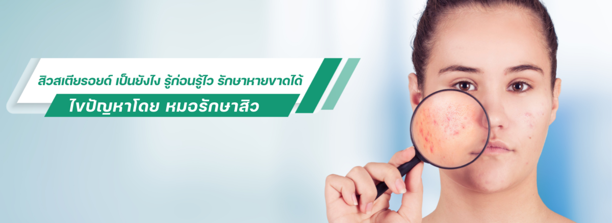 สิวสเตียรอยด์ เป็นยังไง รู้ก่อนรู้ไว รักษาหายขาดได้