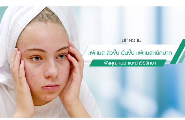 แพ้แมส สิวขึ้น ผื่นขึ้น