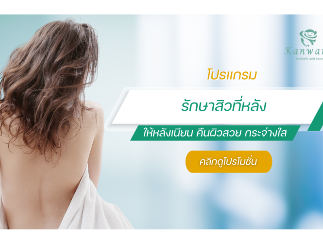 รักษาสิวที่หลัง กัญวราคลินิก