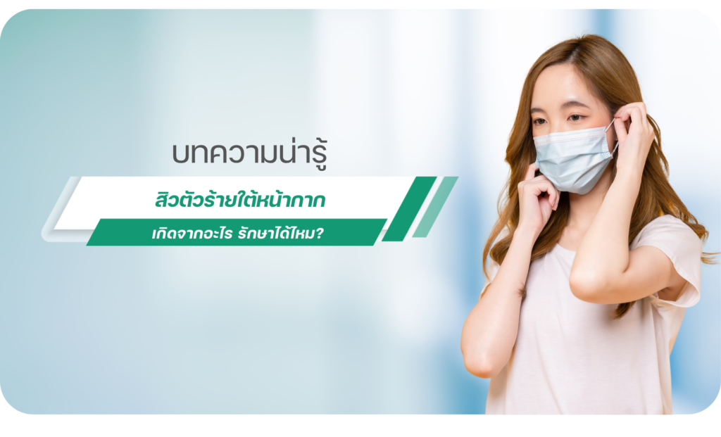 สิวหน้ากาก