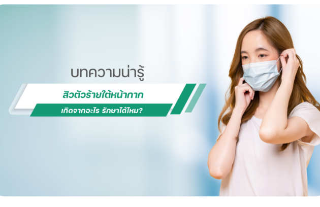 สิวหน้ากาก