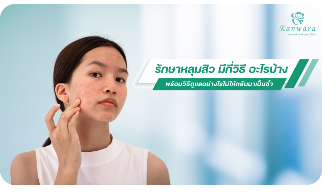 รักษาหลุมสิว มีกี่วิธี อะไรบ้าง พร้อมวิธีดูแลอย่างไรไม่ให้กลับมาเป็นซ้ำ