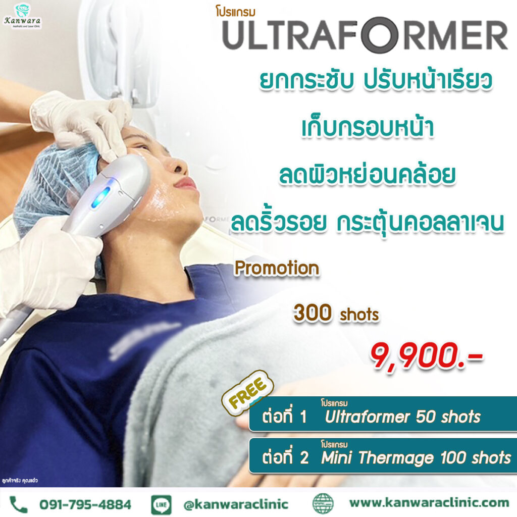 ultraformer ราคา