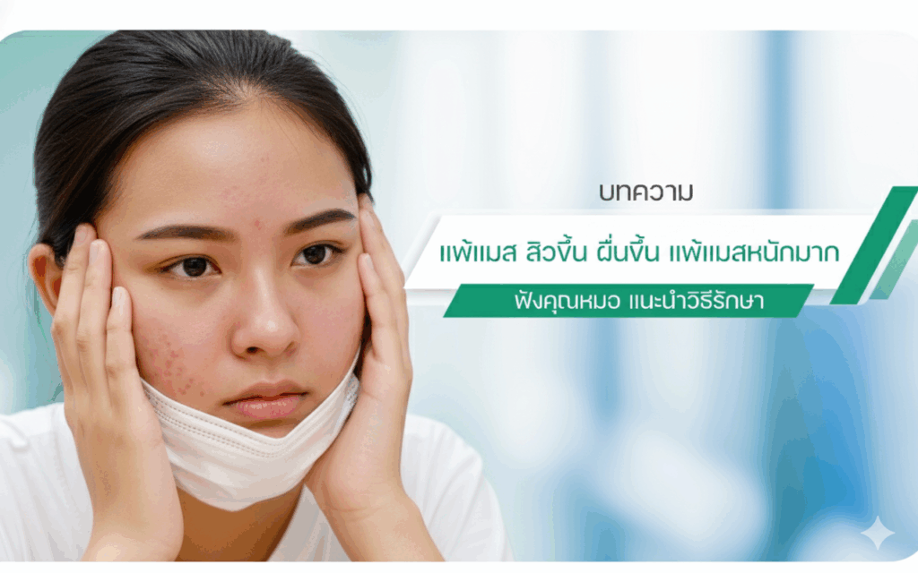 แพ้แมสแก้ยังไง