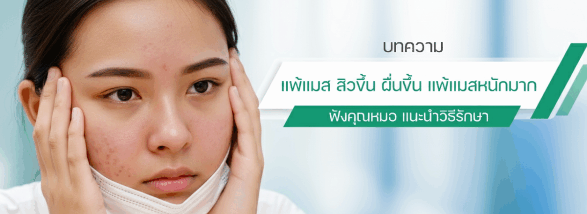 แพ้แมสแก้ยังไง