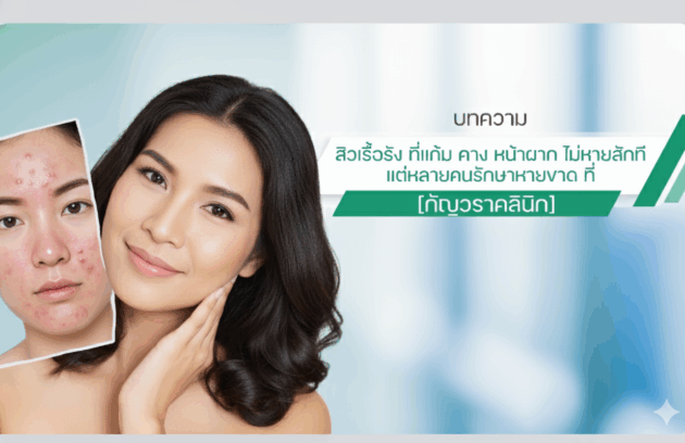 เป็นสิวที่หน้าผาก ไม่หายสักที