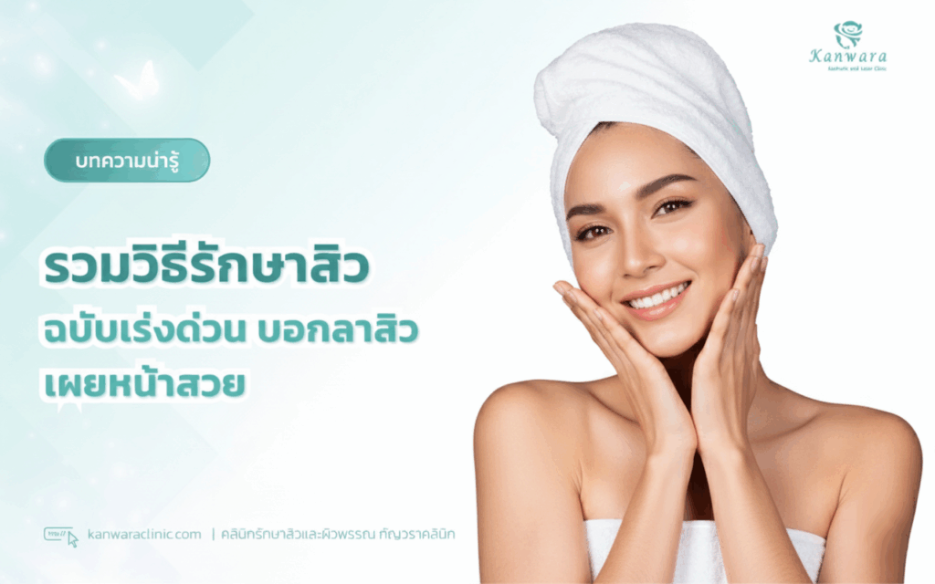 รวมวิธีรักษาสิว ฉบับเร่งด่วน บอกลาสิว เผยหน้าสวย
