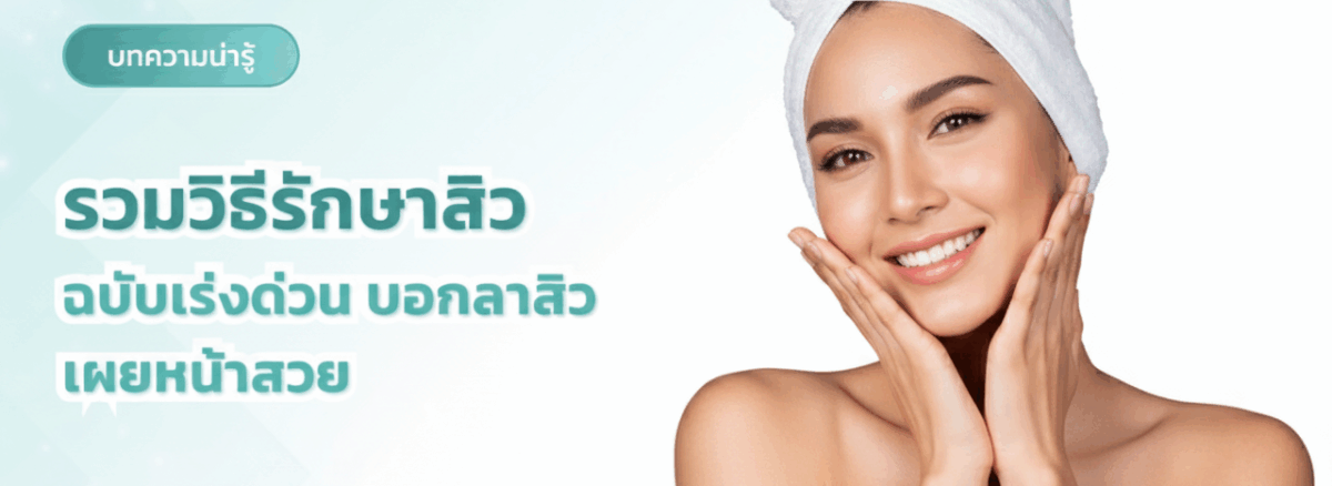 รวมวิธีรักษาสิว ฉบับเร่งด่วน บอกลาสิว เผยหน้าสวย