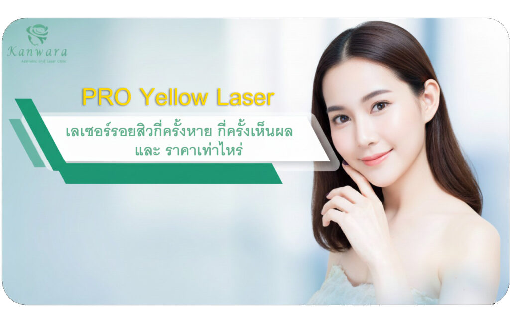 Pro Yello Laser เลเซอร์รอยสิวกี่ครั้งหาย