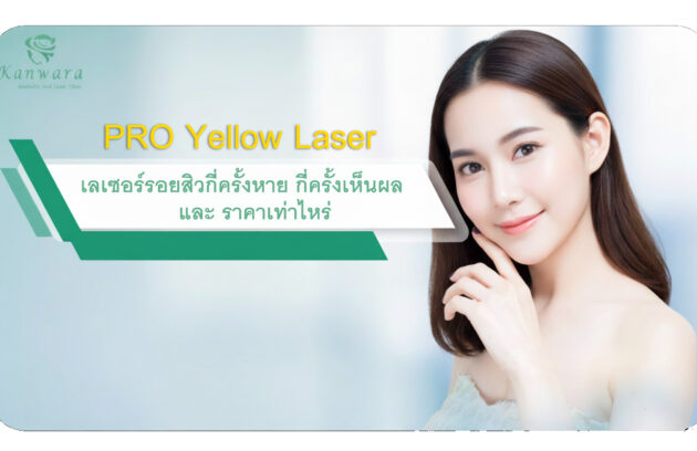 Pro Yello Laser เลเซอร์รอยสิวกี่ครั้งหาย