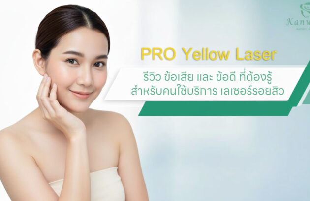 Pro-Yellow-Laser-ราคา