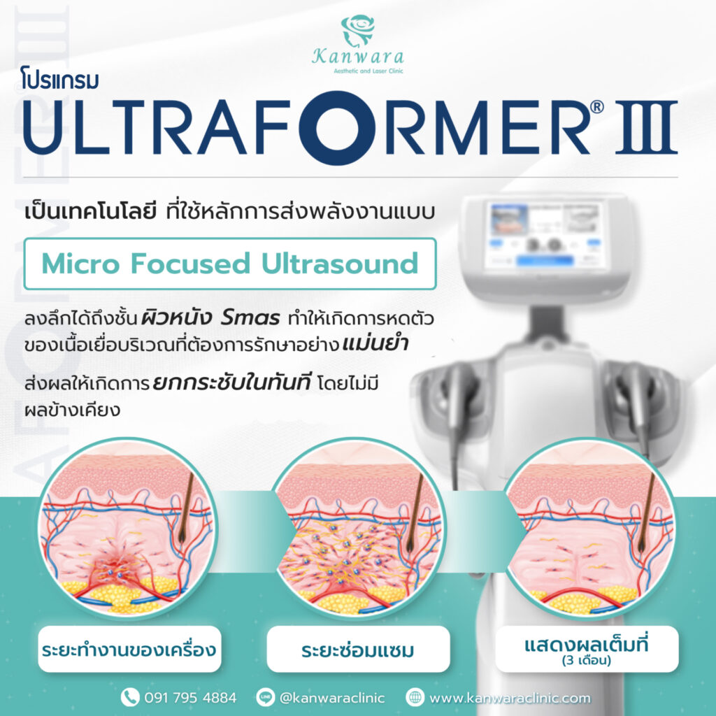 ultraformer เครื่องแท้