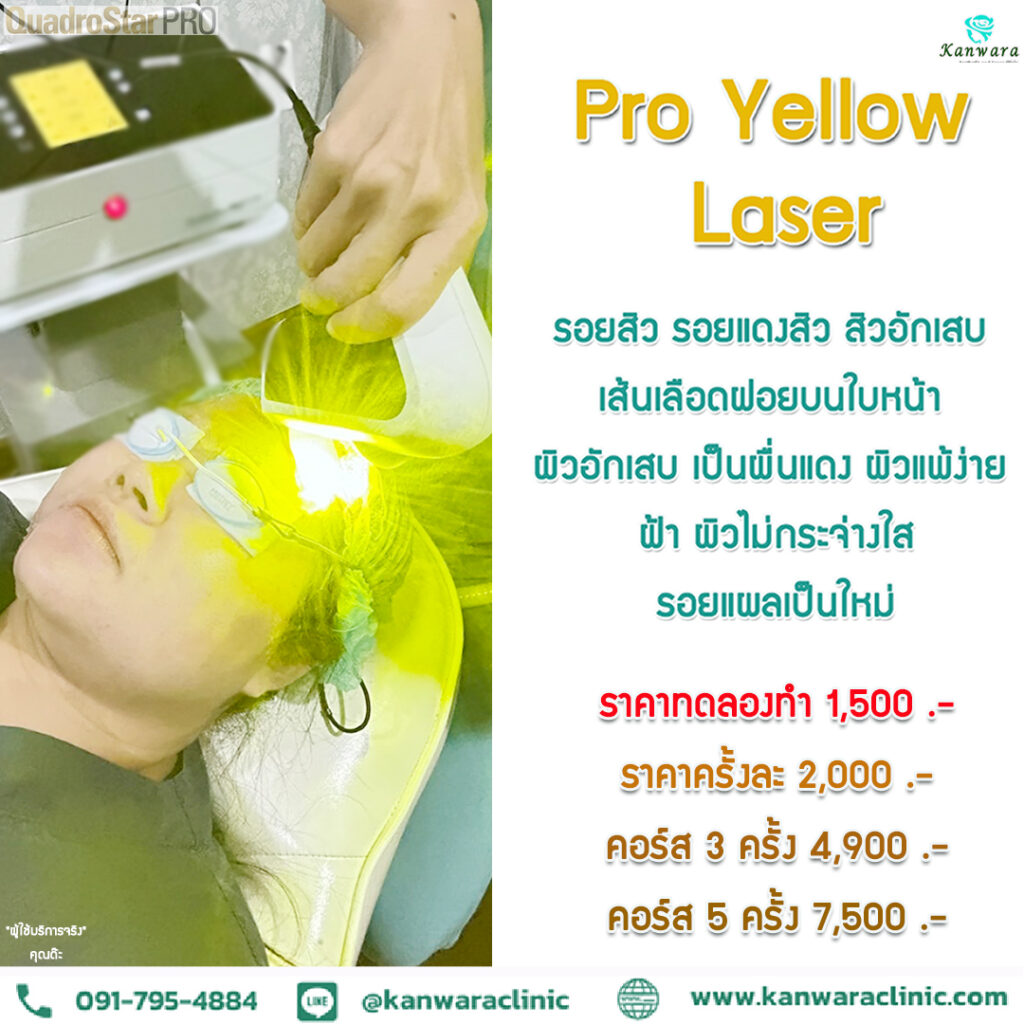 ราคา Pro yellow laser คอร์ส