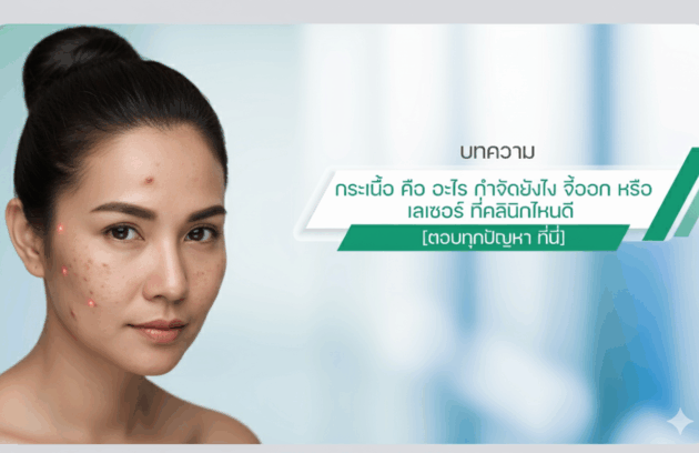 3-ปัจจัย-หรือสาเหตุการเกิดสิว