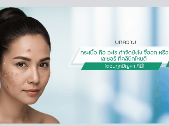3-ปัจจัย-หรือสาเหตุการเกิดสิว