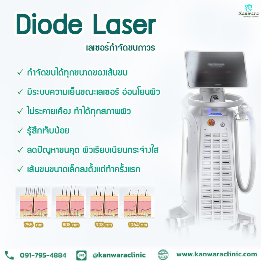 ไดโอด เลเซอร์ขน ราคา