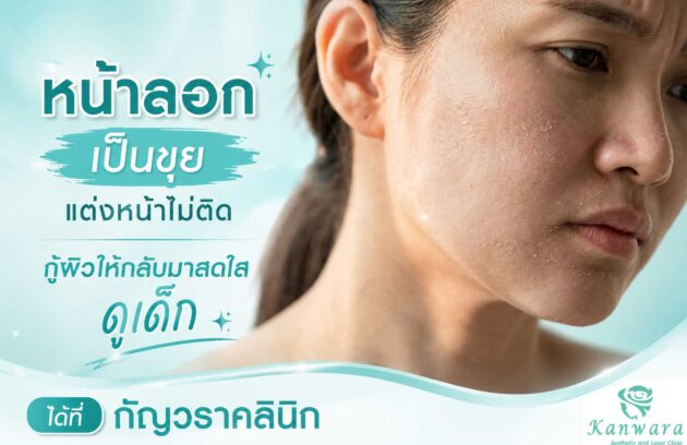 กลับมาสดใส ดูเด็ก ได้ที่ กัญวราคลินิก คลินิกความงาม ใกล้ฉัน