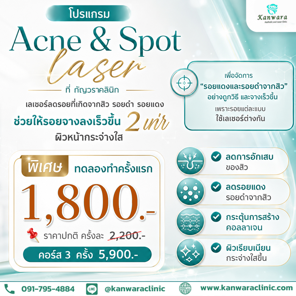 เลเซอร์สิว ราคา พิเศษ