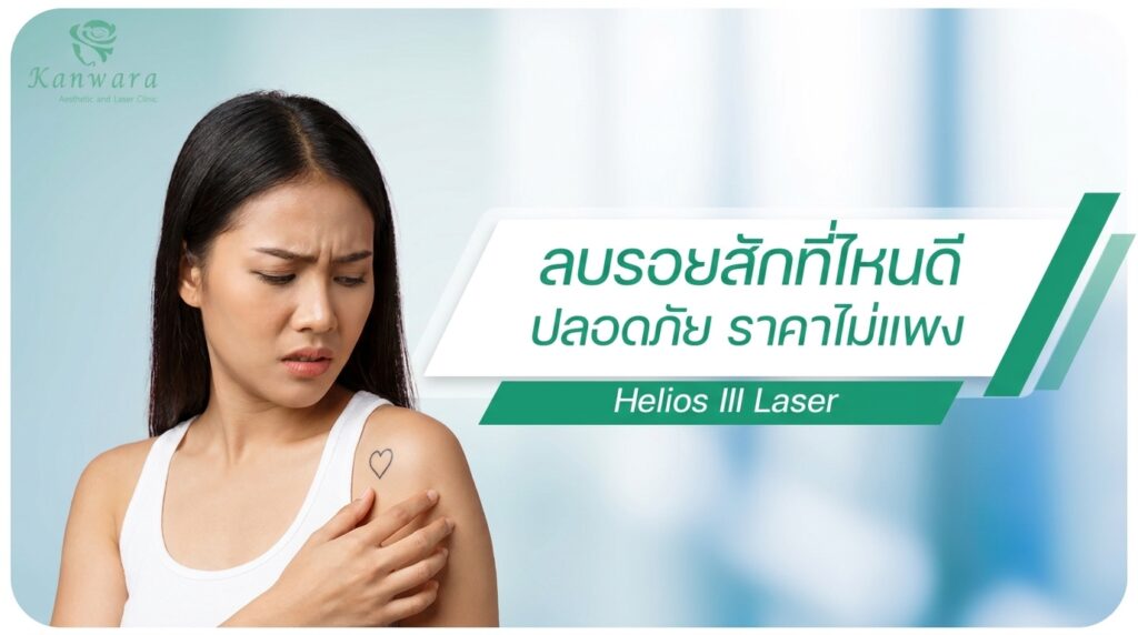 ลบรอยสักที่ไหนดี ใกล้ฉัน กรุงเทพ ราคาไม่แพง
