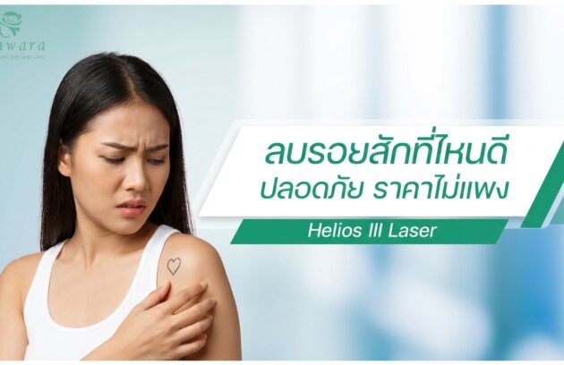 ลบรอยสักที่ไหนดี ใกล้ฉัน กรุงเทพ ราคาไม่แพง