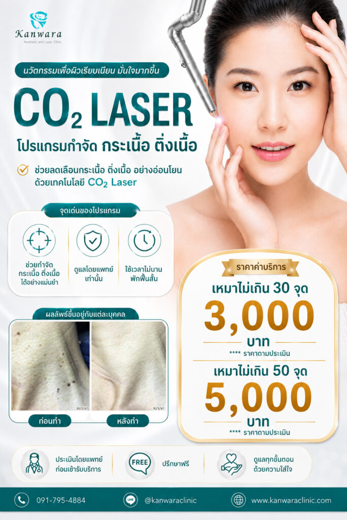 กำจัด กระเนื้อ ติ่งเนื้อ ขี้แมลงวัน ไฝ ใกล้ฉัน
