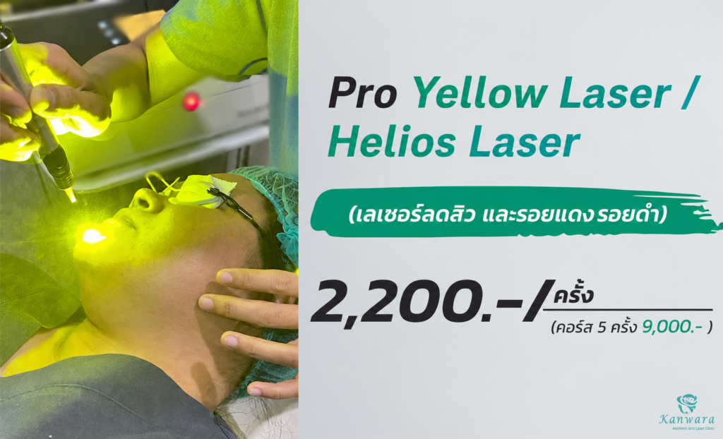 Pro Yellow Laser ราคา Helios Laser ราคา