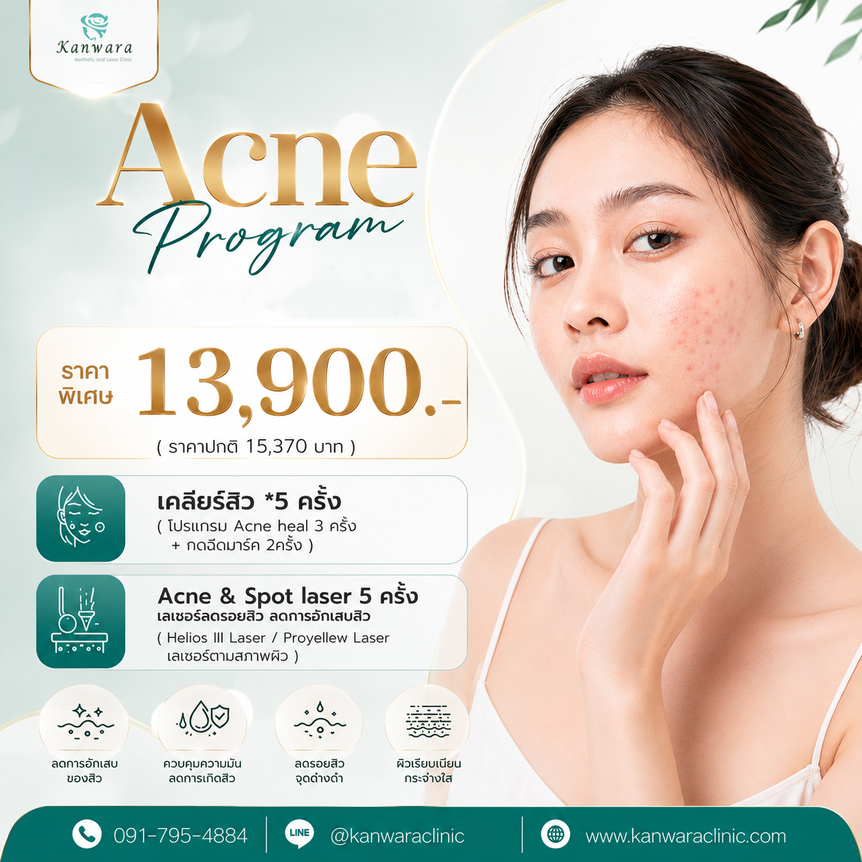 รักษาสิวหายขาด เร่งด่วน ราคา 13900