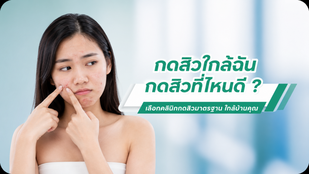 กดสิวใกล้ฉันที่ไหนดี