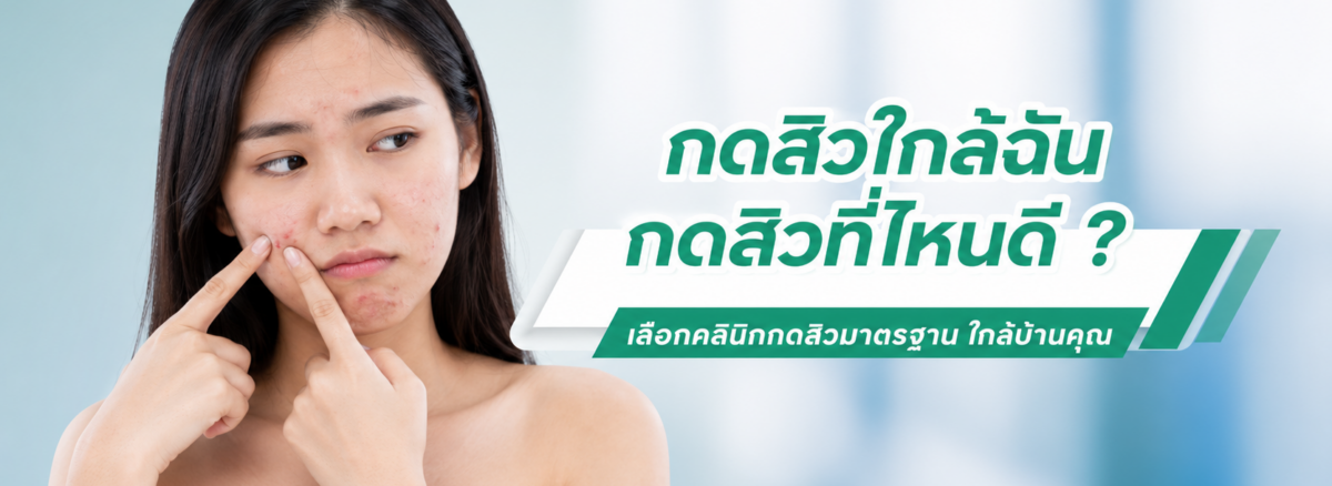 กดสิวใกล้ฉันที่ไหนดี