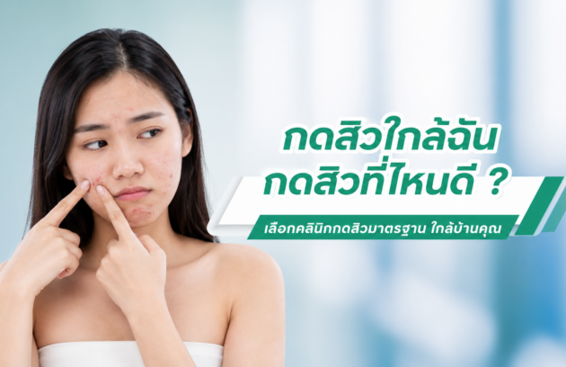 กดสิวใกล้ฉันที่ไหนดี