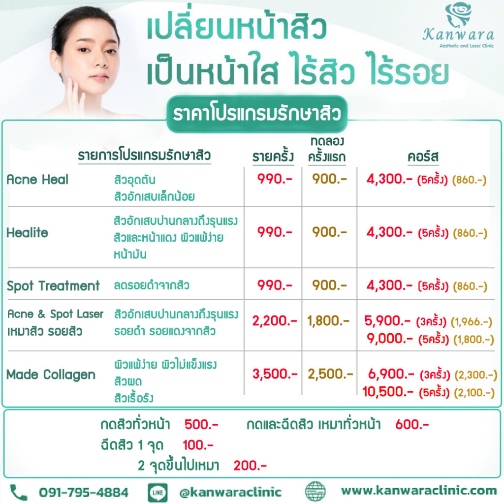 คอร์สรักษาสิวราคา ถูก ตารางราคารักษาสิว 2569