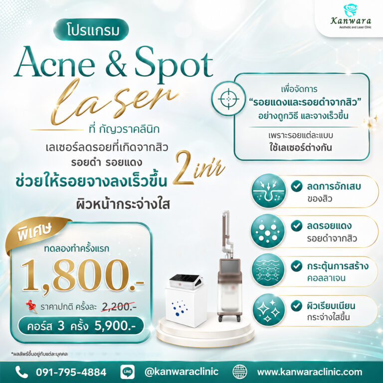 รักษาสิวถูกที่สุดใกล้ฉัน