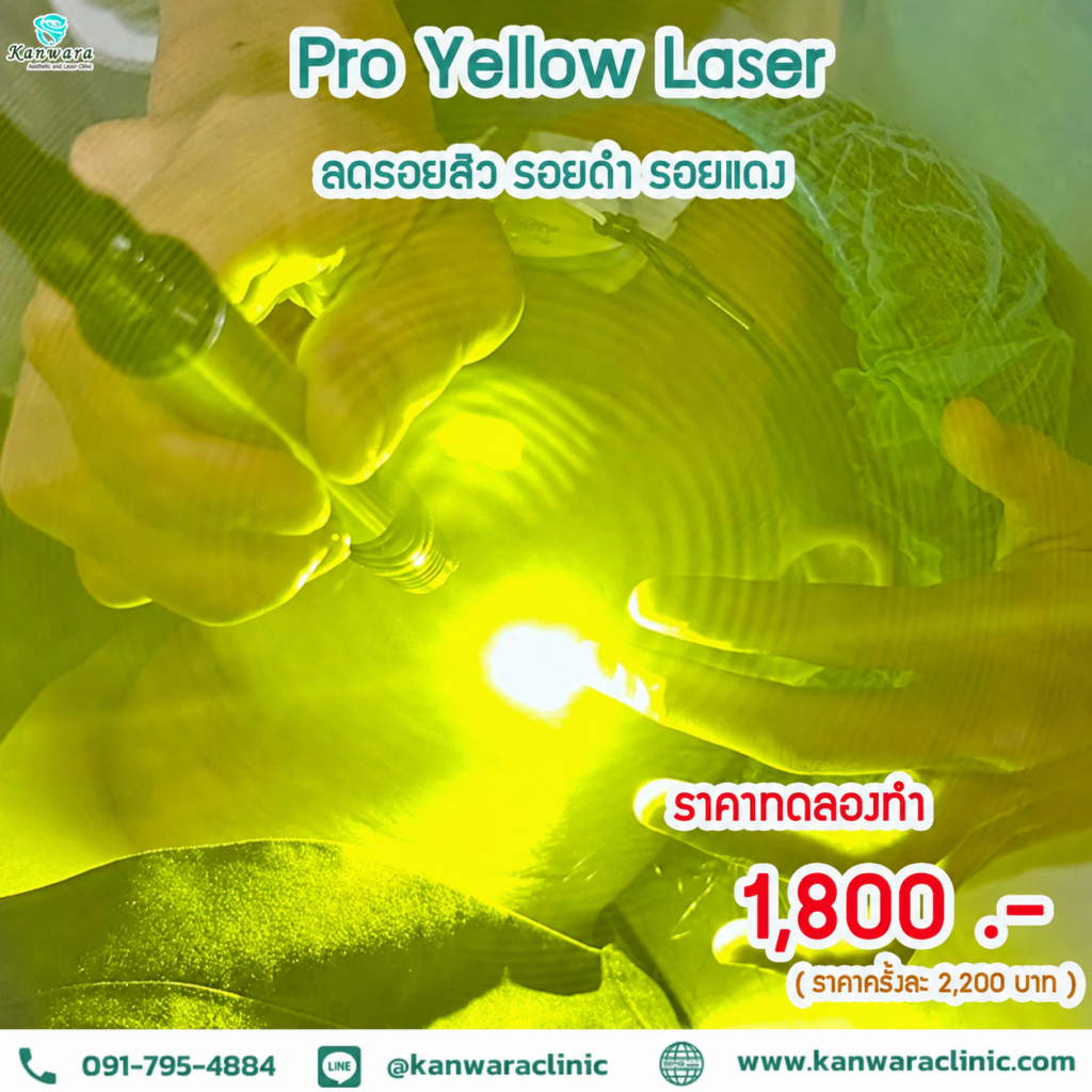 Pro Yellow Laser ราคา ถูกที่สุด ใกล้ฉัน