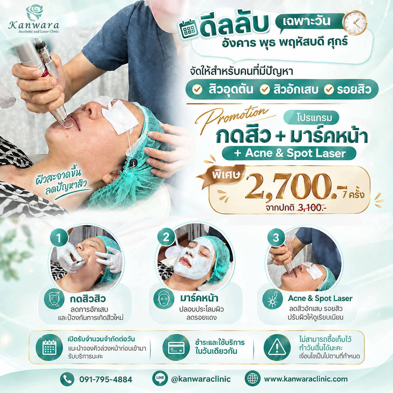 กดสิว ราคา ถูก ใกล้ฉัน